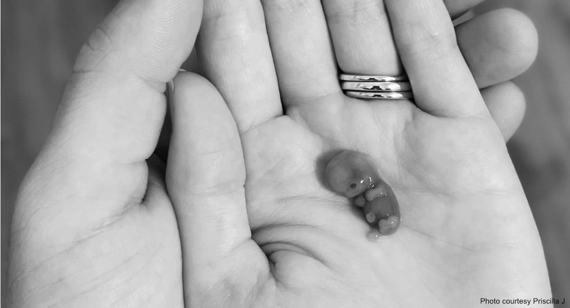9-week-miscarried-baby-2-mom-priscilla-1