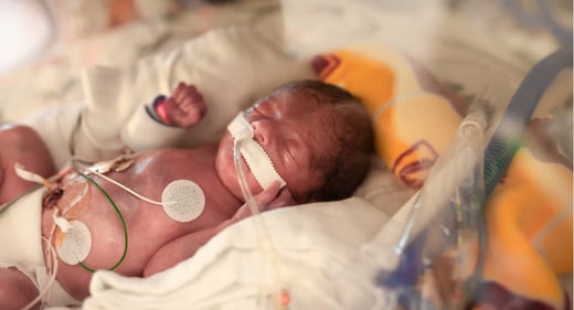 GettyImages-1055349682-29-week-preemie