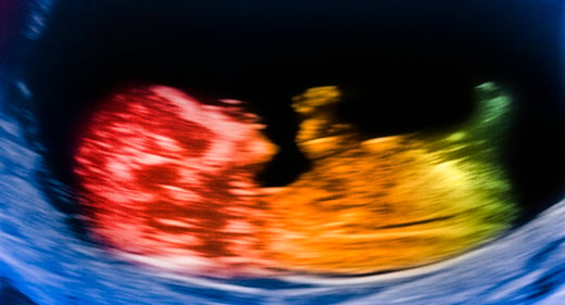 GettyImages-110165600-baby-ultrasound