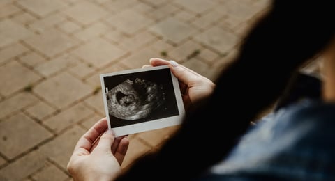 GettyImages-1166850513-pregnant-ultrasound-1