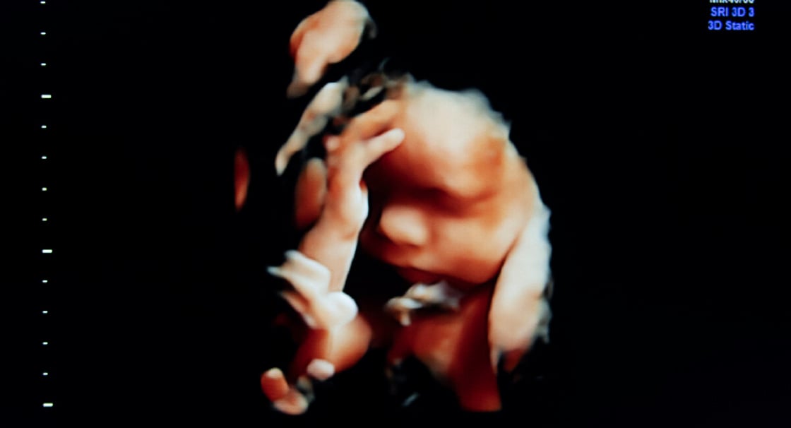 GettyImages-1296420435-fetus-30-week-ultrasound