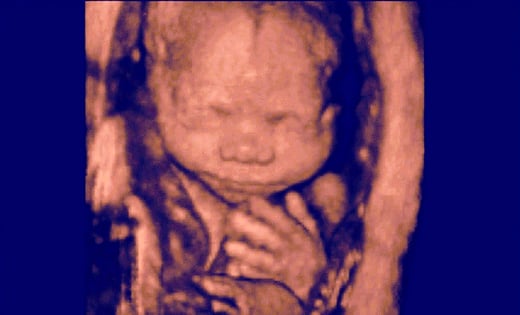 GettyImages-151056179-fetus-24-weeks-ultrasound-2