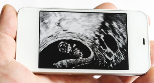 GettyImages-155420217-ultrasound-on-phone