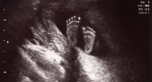 GettyImages-182413050-baby-feet-ultrasound