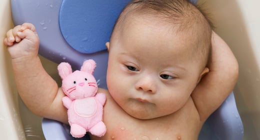 GettyImages-500783071-baby-down-syndrome-1