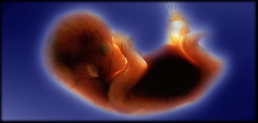 GettyImages-539550463-fetus-preborn-baby-2