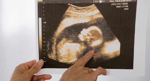 GettyImages-74855234-ultrasound