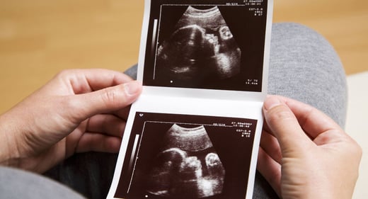GettyImages-92399211-ultrasound