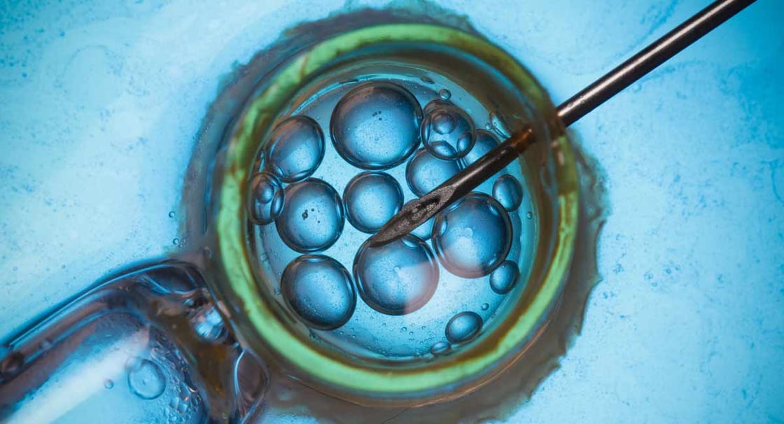 IVF-infertility