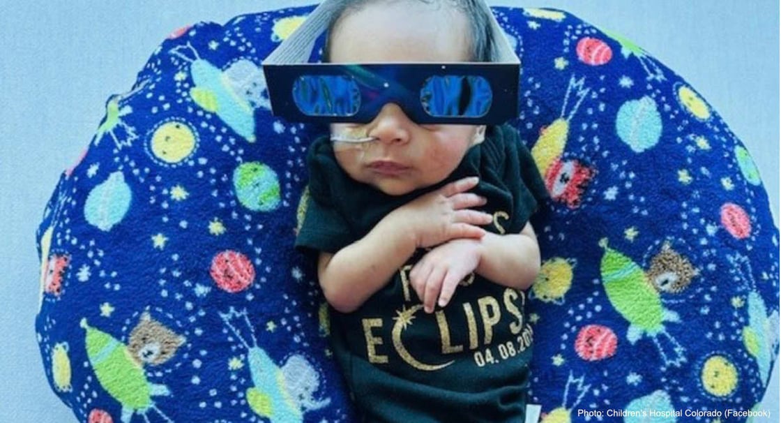 childrens-hospital-colorado-eclipse-baby