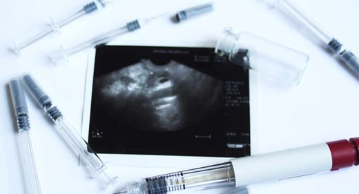 infertility-IVF-ultrasound-1