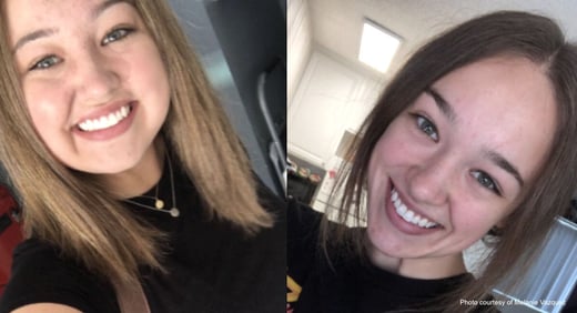 melanie-vazquez-during-and-after-prednisone