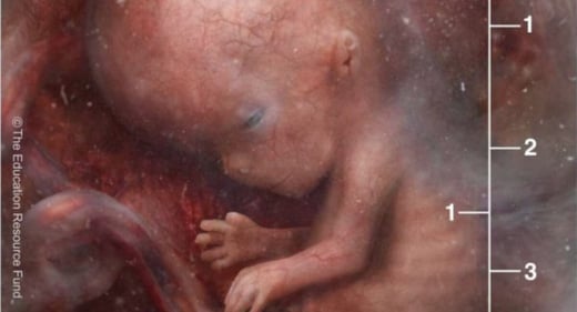 preborn-fetus-9-weeks-post-fertilization