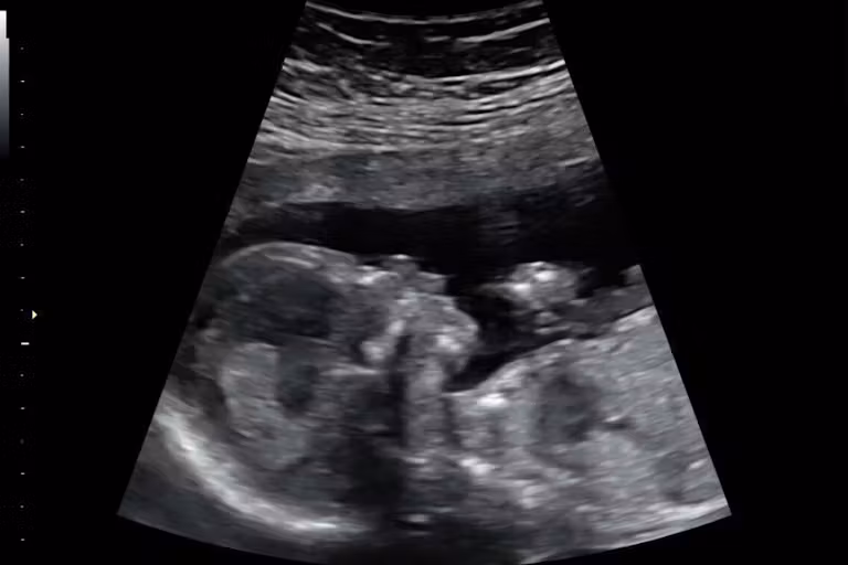 1757975632-baby-evans-1-ultrasound